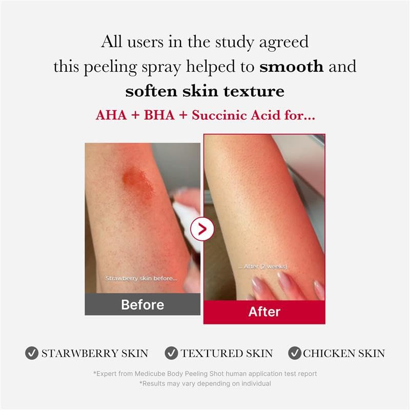 medicube Red Body Peeling Shot, Body Spray Cleanser for Strawberry skin, AHA + BHA + Succinic Acid Helps Reduce Body Breakouts and Bumpy Skin, Smoothing and Exfoliating, 3.88 oz.